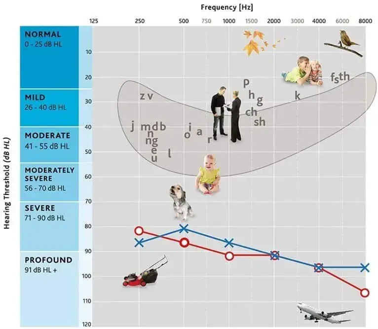 Hearing Loss with Aging, Degrees, Levels hearing loss with aging,hearing loss associated with aging,hearing loss,hearing aid,hearing aids,hidden disability